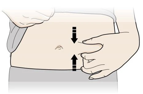 Illustration of a hand pinching the skin
