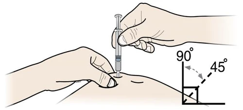 A hand holding a syringe to inject a drug into an arm while another...