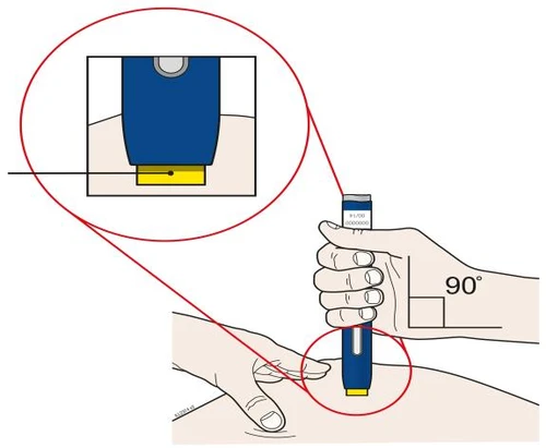 Medical illustration showing a hand holding a blue and yellow device for a...