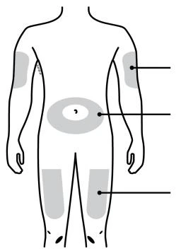 Human body diagram with gray highlighted areas on arms, abdomen, and thighs, connected by black lines to specific injection or application points