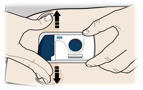 Two hands holding and positioning a rectangular medical device on the arm skin with black arrows indicating vertical movement
