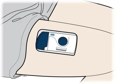 A rectangular medical device with a circular button and a window being applied to the skin of the abdominal area