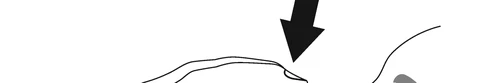 Medical diagram with a black arrow pointing downward indicating a specific point on a light curved surface