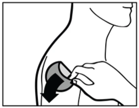 Disegno lineare di una mano che applica un cerotto o un dispositivo medico sulla parte superiore della schiena di una persona con una freccia verso il basso