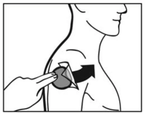 Disegno in bianco e nero che mostra una mano che applica un cerotto circolare sulla parte superiore della spalla di un uomo con una freccia direzionale