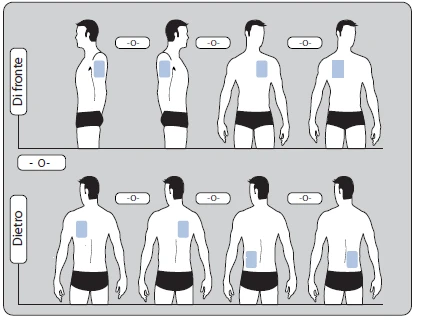 Medical diagram with four front-view male figures and four back-view figures showing body zones for application