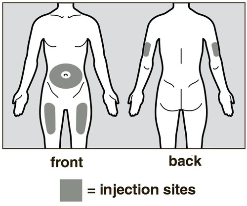 Diagramma del corpo umano frontale e posteriore con aree grigie che indicano i siti di iniezione sull'addome, sulle cosce e sulle braccia