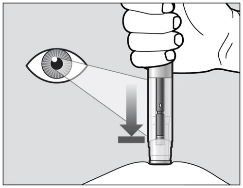 Disegno schematico che mostra una mano che impugna un dispositivo medico puntato verso la pelle con una freccia che indica la direzione verso il basso