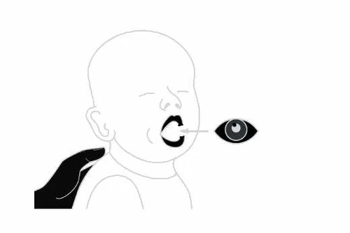 Линейный рисунок новорождённого с стрелкой, указывающей на рот, и отдельно расположенным глазом справа, обозначающим приём лекарства перорально