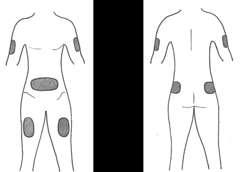 Schematic drawing of a human body viewed from front and back, with gray areas indicating application sites on arms, abdomen, hips, and thighs