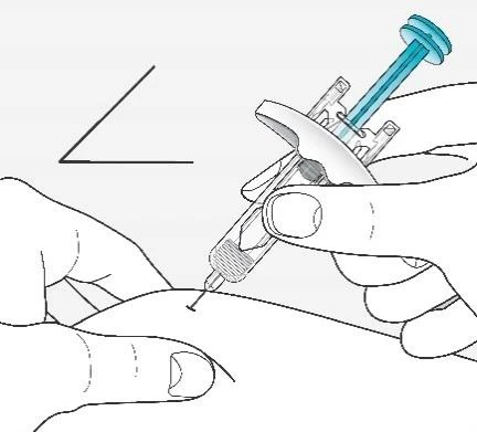 Disegno tecnico che mostra una mano che tiene una siringa con ago inclinato a 45 gradi per un'iniezione sottocutanea sulla pelle