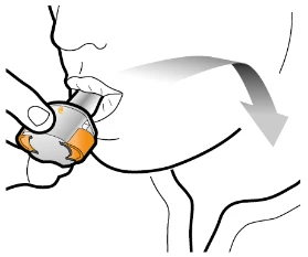 Disegno schematico di una mano che inserisce un dispositivo medico in bocca con una freccia che indica il movimento verso la gola