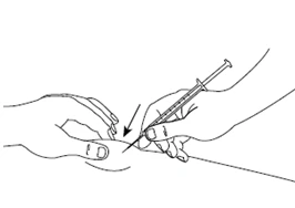 Disegno a tratto di due mani che eseguono un'iniezione con una siringa su una parte del corpo con una freccia che indica il punto di inserimento
