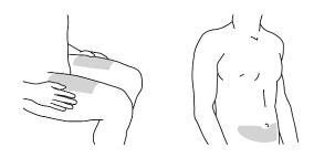 Disegno lineare di un torso maschile che mostra due aree grigie per l'applicazione del farmaco sulla parte inferiore dell'addome e sulla coscia