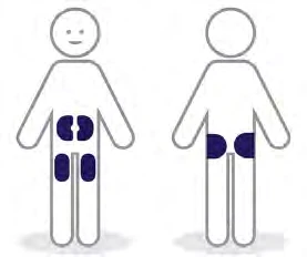Stylized diagram of two human figures showing drug application areas on the