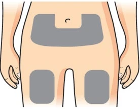 Disegno di un torso e gambe con tre grandi cerotti grigi applicati sull'addome e su ciascuna coscia