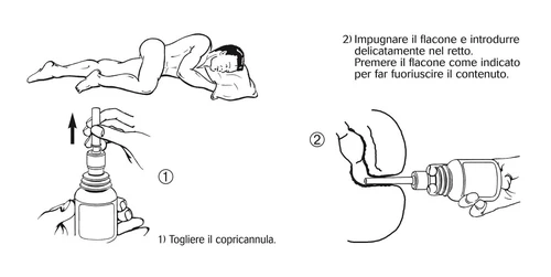 Disegno medico che illustra due passaggi: rimuovere il copricanula dal flacone e inserire delicatamente il flacone nel retto premendo per espellere il contenuto