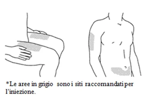 Disegno schematico di un uomo che mostra le aree grigie sul gluteo e sull'addome indicate come siti raccomandati per l'iniezione