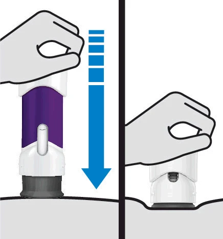 Illustrazione di due mani che impugnano un dispositivo medico viola e bianco per applicarlo sulla pelle con un movimento verso il basso