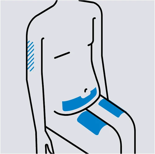 Disegno schematico di un torso umano con aree blu evidenziate sulla parte superiore del braccio, sull'addome e sulle cosce per indicare le zone di applicazione
