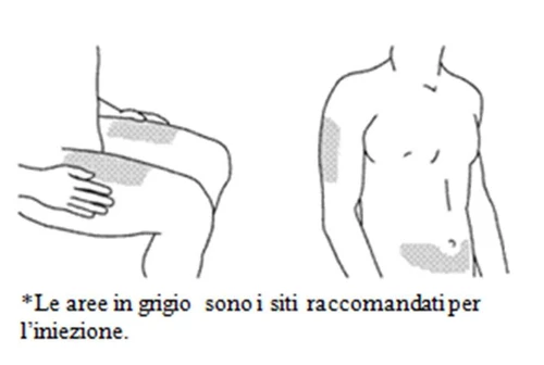 Disegno schematico di un busto maschile e di una gamba con aree grigie che indicano i siti raccomandati per l'iniezione su braccio, coscia e addome