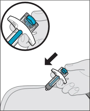 Una mano impugna un dispositivo medico azzurro e bianco per applicarlo sulla pelle del corpo seguendo la direzione indicata dalla freccia nera