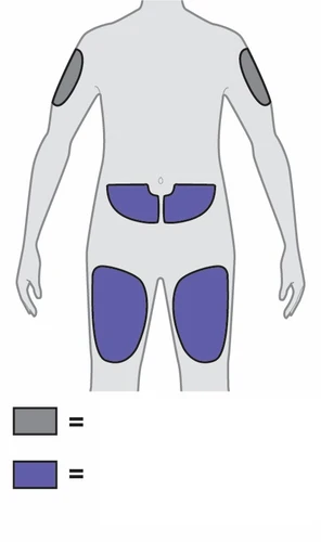 Diagramma del corpo umano con aree grigie sulle braccia e aree viola sull'addome e sulle cosce per indicare i siti di applicazione del farmaco