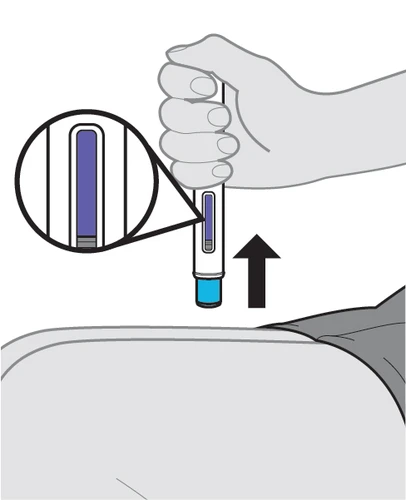 Una mano impugna una penna iniettore sopra la coscia di una persona con una freccia nera rivolta verso l'alto e un ingrandimento del liquido blu