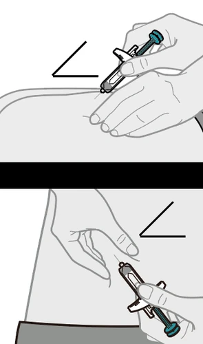 Technical drawing showing two stages of the