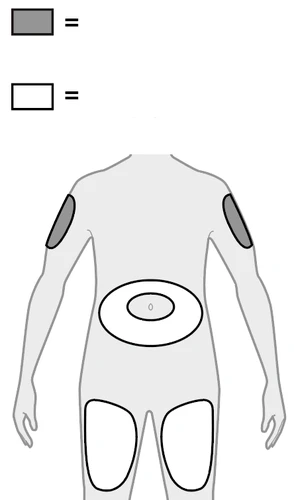 Human body diagram with gray areas on the arms and white areas on