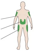 Human body diagram with green areas indicating injection sites on arms, abdomen, hips, and thighs, with lateral reference lines