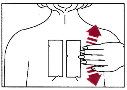 Dibujo esquemático del torso de una persona con dos vendas rectangulares en el pecho y una mano que indica con flechas rojas el movimiento vertical