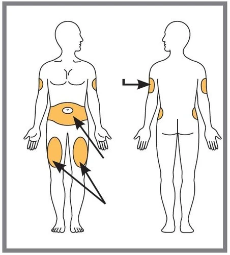 Diagramma di due figure umane che indicano le zone di applicazione del farmaco con macchie arancioni su braccia, addome e cosce