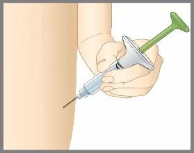 Una mano impugna una siringa con un pistone verde per iniettare il liquido attraverso l'ago nella pelle di una coscia o di un braccio