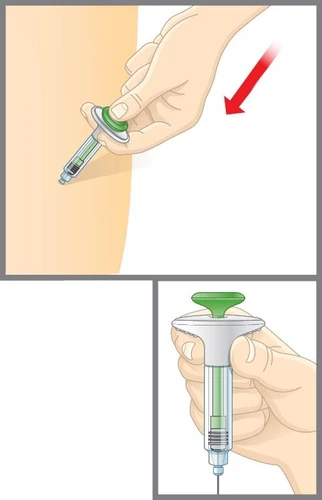 Una mano impugna un dispositivo medico con punta verde e corpo trasparente contenente liquido per l'iniezione su una superficie cutanea chiara