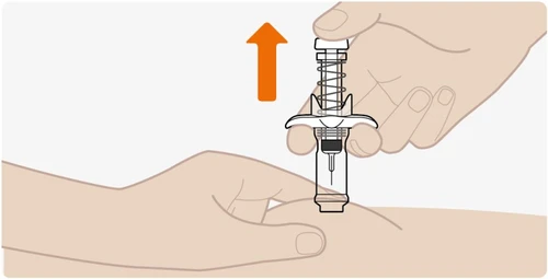 Una mano solleva verso l'alto un dispositivo medico a vite con una freccia arancione che indica il movimento di estrazione dal braccio