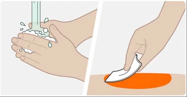 Due illustrazioni mostrano mani che si lavano con acqua e schiuma e una mano che applica un cerotto su una zona della pelle evidenziata in arancione