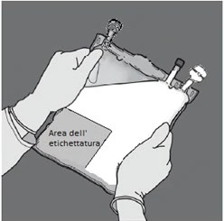 Two gloved hands supporting an infusion bag with a
