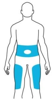 Schematic of a male human body with blue highlighted areas on the abdominal region and upper right and left thighs
