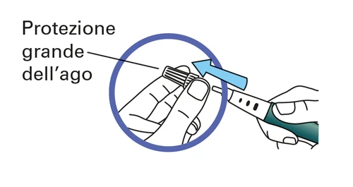 Hands inserting the large protective cap