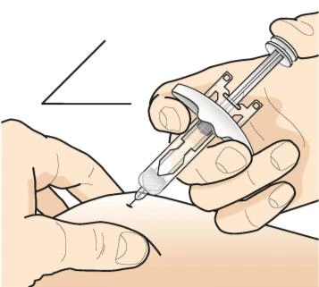 Due mani tengono una siringa per iniettare un farmaco nel braccio con un angolo di circa 45 gradi rispetto alla pelle