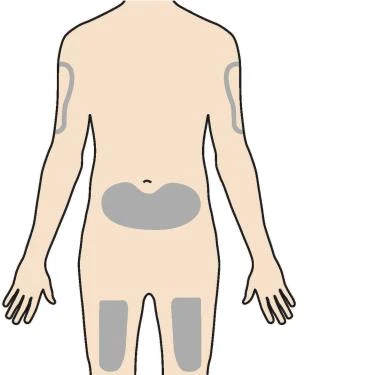 Diagramma del corpo umano visto di schiena con aree grigie evidenziate sulle braccia, sull'addome e sulle cosce