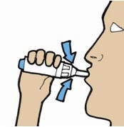 Illustrazione di una mano che tiene un dispositivo medico bianco vicino alla bocca di una persona con due frecce azzurre che indicano l'inserimento