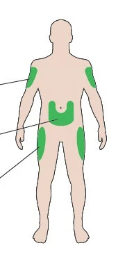 Diagram of a human body with green highlighted areas on the shoulders, on the