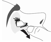 Disegno schematico di un volto che mostra una mano che tira delicatamente la pelle sotto l'occhio verso il basso con una freccia nera