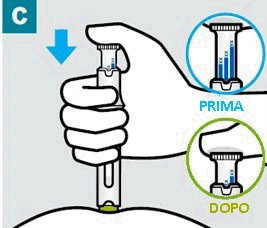 Ilustración médica que muestra una mano que presiona una pluma inyectable sobre una superficie con dos círculos que muestran el detalle antes y después de la