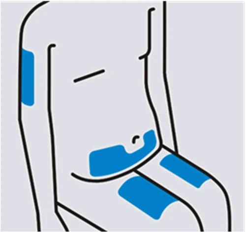 Diagrama estilizado de un torso humano con tres círculos azules aplicados en la parte superior del brazo, en el