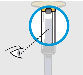 Ilustración médica que muestra un ojo que observa a través de una lupa circular azul el contenido líquido en el