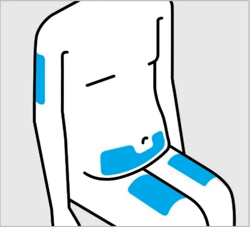 Dibujo esquemático de un torso humano con áreas azules resaltadas en la parte superior del brazo, en el