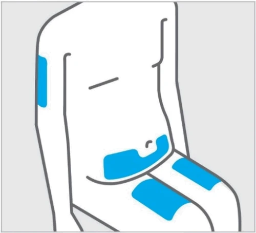 Diagrama estilizado de un torso humano con áreas azules resaltadas en la parte superior del brazo, en el